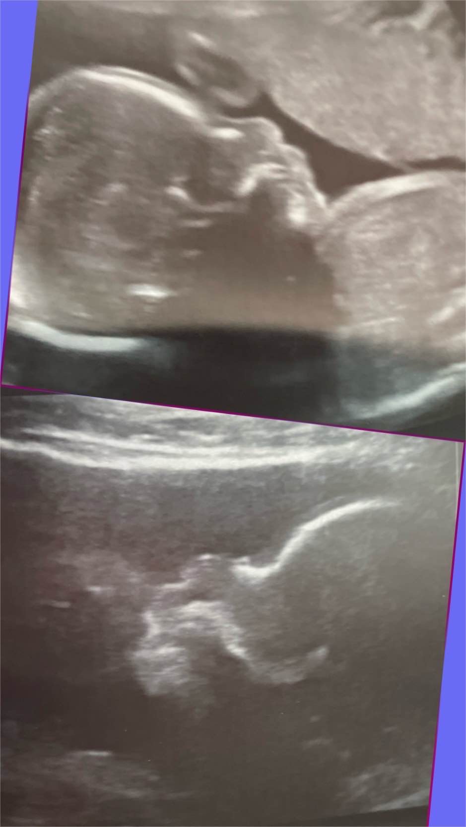 babysmithtwins