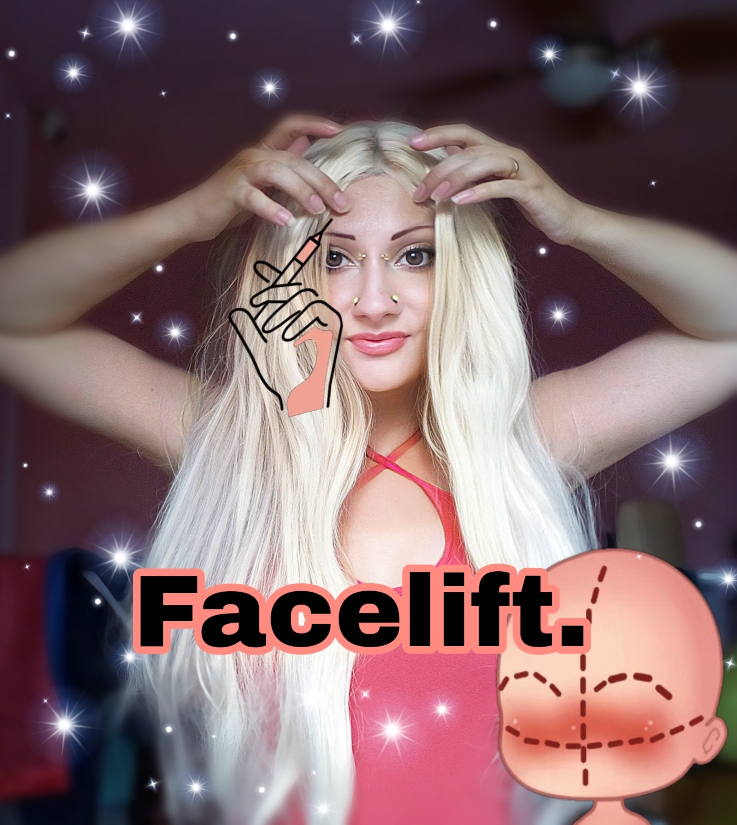 Facelift.