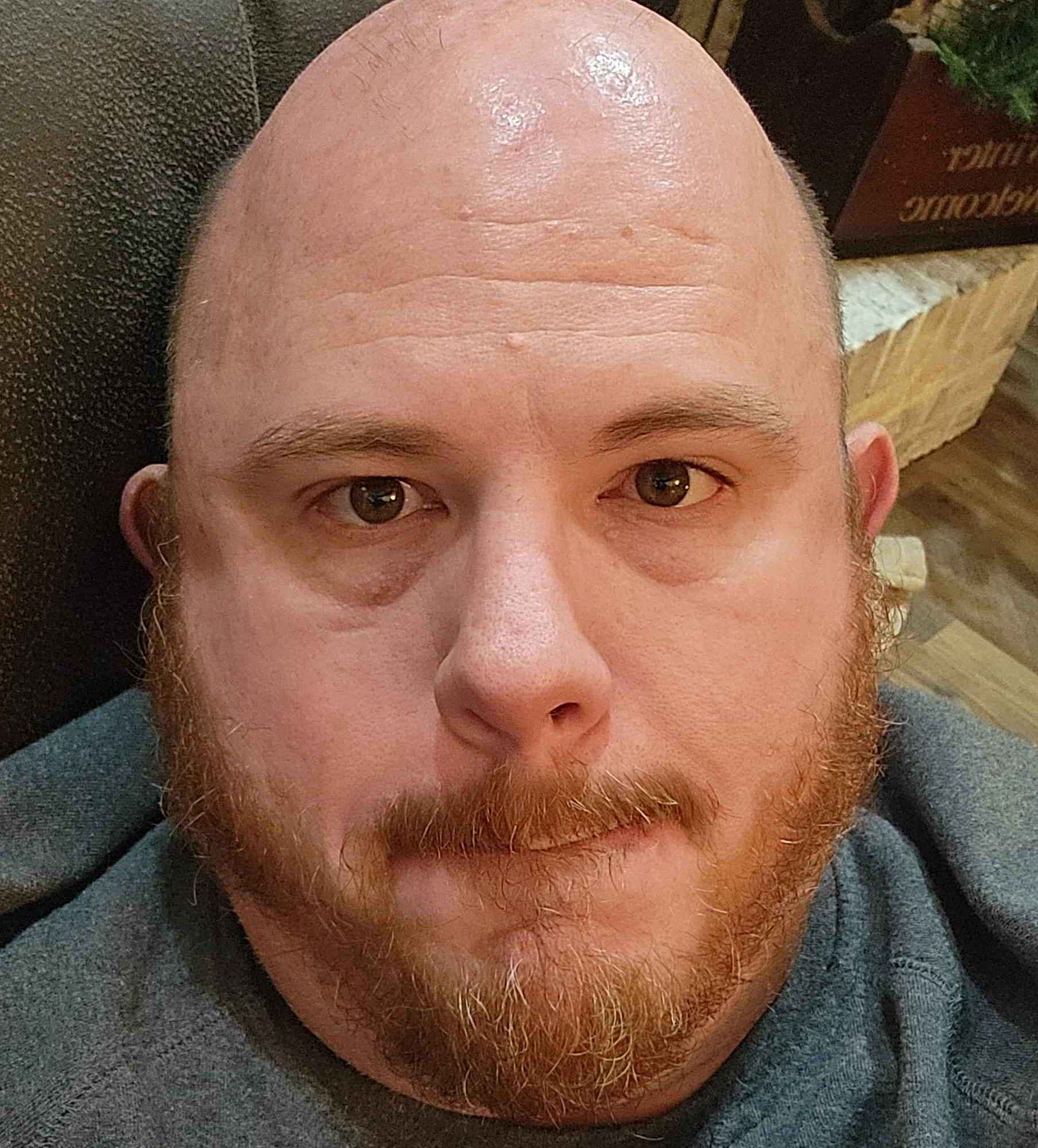 robedalex