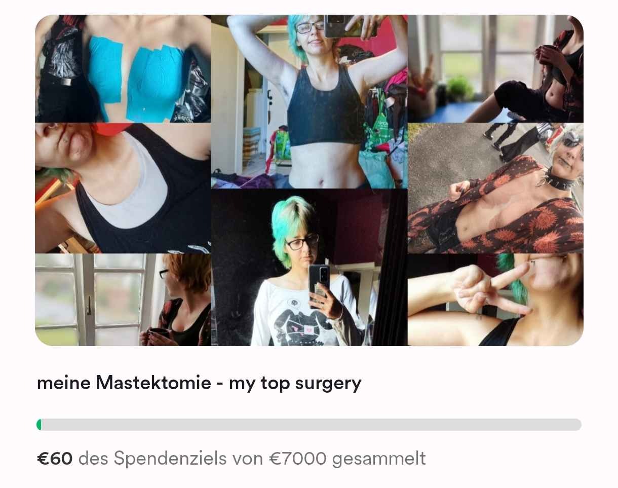 meine Mastektomie - my top surgery