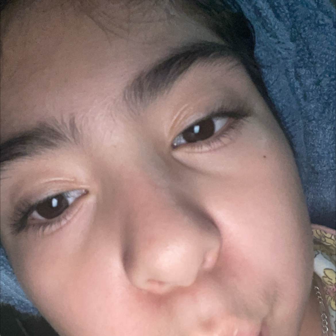 ste